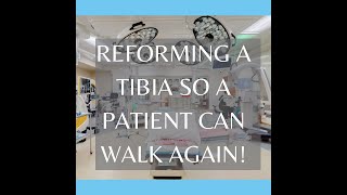 Reforming a Tibia So a Patient Can Walk Again! #OrthopedicSurgeon