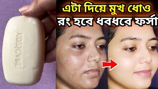 রোজ দিনে দুবার করে এই জিনিসটা দিয়ে মুখ ধোও রং ধবধবে ফর্সা হবে/মুখের কালো দাগ দূর করার উপায়/D-tan