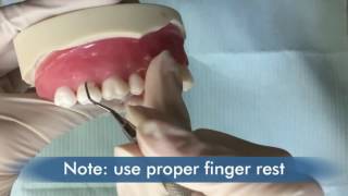 Dentiscope | HOW TO USE SUBGINGIVAL SCALERS