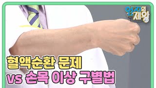 손 저림! ＜혈액순환 문제 vs 손목 이상＞ 구별하는 방법! MBN 220503 방송