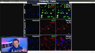 Python - Computer Vision Pt 2 - VDB Computational Biology