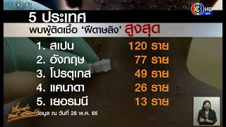 เผย 5 ประเทศ พบผู้ติดเชื้อ 'ฝีดาษลิง' สูงสุด - 'อนุทิน' เผยผลตรวจผู้ป่วยสงสัย จากประเทศเฝ้าระวัง