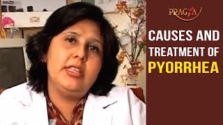 Watch Causes and Treatment of Pyorrhea