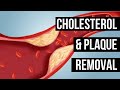 ❋ Powerful Cholesterol and Plaque Removal! ~ Rife Frequencies ~ Relaxing Rain Sounds