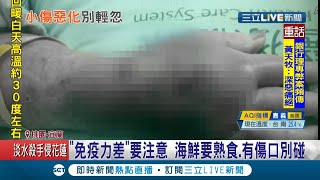 男子刮魚鱗竟差點奪命..整隻手臂發黑發腫..爆原來感染海洋弧菌急開刀治療│記者 黃國瑞 洪儀婷│【LIVE大現場】20201116│三立新聞台