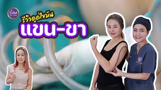 รีวิวดูดไขมันแขนและขา คุณเกด::: [Siam Loft Clinic]