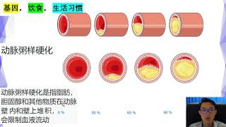 心脏血管系统2 缺血性心脏疾病