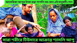 আমেরিকা আপুর টাকা রত্না পাগলি না পেয়ে কেন এই মানুষটি পেল | যার সারা শরীরে টিউমারের বসবাস | শ্যামলি