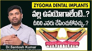 డెంటల్ ఇంప్లాంట్స్ || Benefits of Zygoma Dental Implants in Telugu || Eledent Dental Hospitals