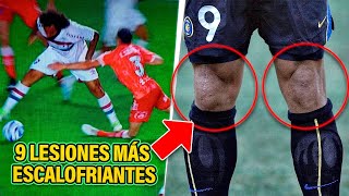 Las 9 LESIONES MÁS ESCALOFRIANTES En Un Campo De Futbol 💀⚽