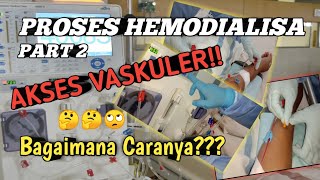 Proses Hemodialisa/Cuci Darah || Tutorial Prosedur Akses Vaskuler Cimino || Part 2