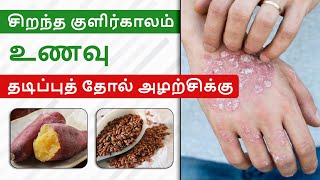 தடிப்புத் தோல் அழற்சிக்கு சிறந்த குளிர்கால உணவு | Best Diet Plan for Psoriasis Patients| Dr. Megha