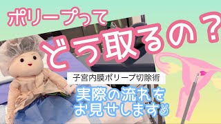 「子宮内膜ポリープ切除　ポリープってどう取るの？」　『POSITIVE 妊活！』シリーズ　IVFなんばクリニック