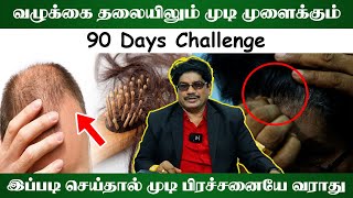 வழுக்கை தலையிலும் முடிமுளைக்கும் | 90 days challenge | இப்படி  செய்தால் முடி பிரச்சனையே வராது