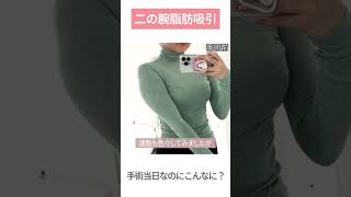 手術当日なのにこんなに脂肪が？二の腕脂肪吸引　＃Shorts