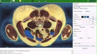 Using VTK in the Reconstruction of the Human Body