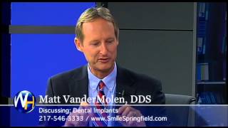 Dental Implants, Matt VanderMolen DDS, Springfield, IL