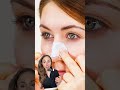 Do Pore Strips Damage Your Skin? #dermatologist