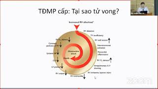 Xử trí thuyên tắc động mạch phổi cấp tính | CẤP CỨU TIM MẠCH (buổi 5)