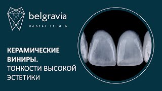 👄  Керамические виниры. Тонкости высокой эстетики