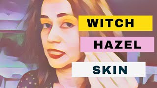 The Truth About Witch Hazel in SkinCare