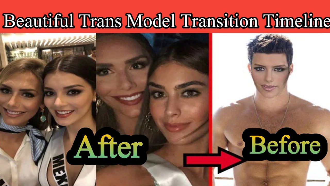 Male To Female Trans Model Mtf Transition Timeline Beautiful Trans