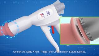 LangHe Medical - CircCurer - Disposable Circumcision Suture Device - 2nd generation-Demo