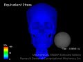 quantitative ct based finite element analysis of hit by pitch