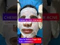 Best Chemical Peel Treatment for acne at Skinaa Clinic | Viral #shorts