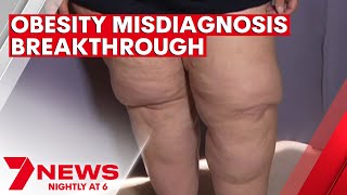 A breakthrough unlocking the cause of fat growth for thousands of women | 7NEWS