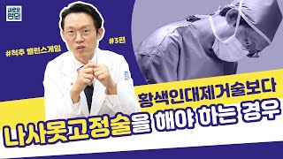 황색인대제거술보다 \