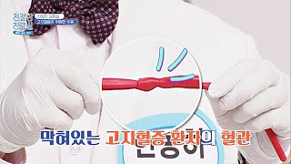 [친절한 실험실🧐] 혈관을 막는 고지혈증! 고지혈증이 위험한 이유는? | 친절한 진료실 172회 | JTBC 240513 방송