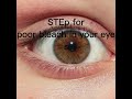 a Tutorial how to poor bleach in your eyes