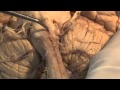 The Most Important Pathway: Motor Control: Neuroanatomy Video Lab - Brain Dissections