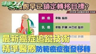 最新癌症追蹤技術 精準醫療防範癌症復發移轉 健康2.0