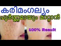 Pigmentation &Darkspots നു  100% result  കിട്ടുന്ന Natural Remedy|DIY serum For highPigmention