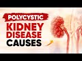 Polycystic Kidney Disease Causes