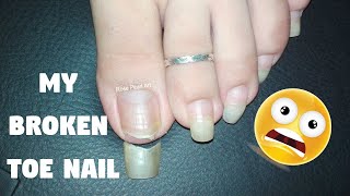 My BROKEN Toe Nail 😫 DIY Toe Nail Care Tips | Rose Pearl