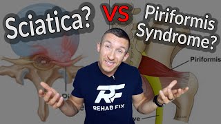 Sciatica VS Piriformis Syndrome | 3 Quick Tests to Try!