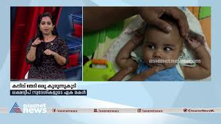 സ്‌പൈനൽ മസ്ക്കുലർ അട്രോഫി; നാല് മാസമുള്ള കുഞ്ഞും ചികിത്സാ സഹായം തേടുന്നു|SMA Treatment|Ishal Mariyam