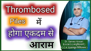 Thrombosed piles में मिलेगा फ़ायदा | घरेलू ईलाज