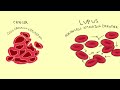 lupus myths vs facts by lupuschick.com