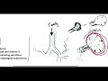 cpap bpap avaps introduction to non invasive ventilation strategies explained clearly