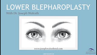 Lower Blepharoplasty