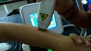 portable 755nm 808nm 1064nm diode laser for hair removal