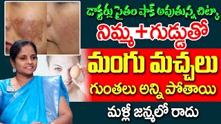 Dr Lakshmi - 5 రోజుల్లో మీ పిగ్మెంటేషన్ కి, నల్ల మచ్చలు అన్ని మాయం | Remove pigmentation | iDream