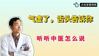 气虚了，舌头告诉你。一个方子，健脾益气、气血双补、告别虚弱