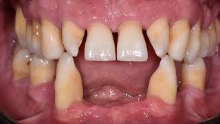 DUS ÖZEL: Periodontal Hastalıkların Sınıflandırılması - BÖLÜM 1