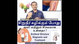 Stricture Urethra  treatment / சிறுநீர் கழிக்கும் போது வலி ? சிரமம் இருக்கிறதா ? Dr A S karthikeyan