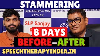 Pre-Post | हकलाहट Stammering Speech Therapy Within 8 Days | By #slpsanjaykumar | AIIMS Delhi Alumnus